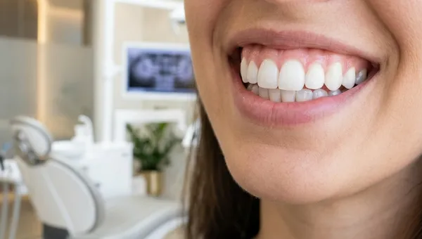 Diseño de Sonrisa en Miraflores: Guía, Precios y Qué Esperar